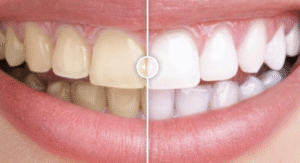 Before & After Image Comparison WP Plugin 1.0.1